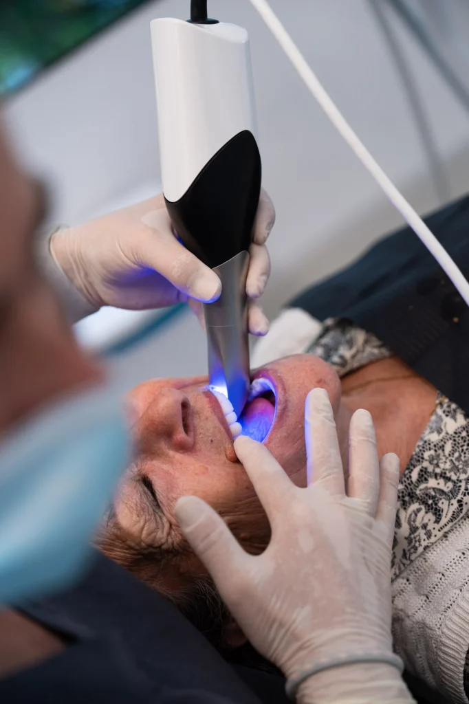 Implantes Dentales sin Tornillos: ¿Qué son y en qué casos se recomienda?