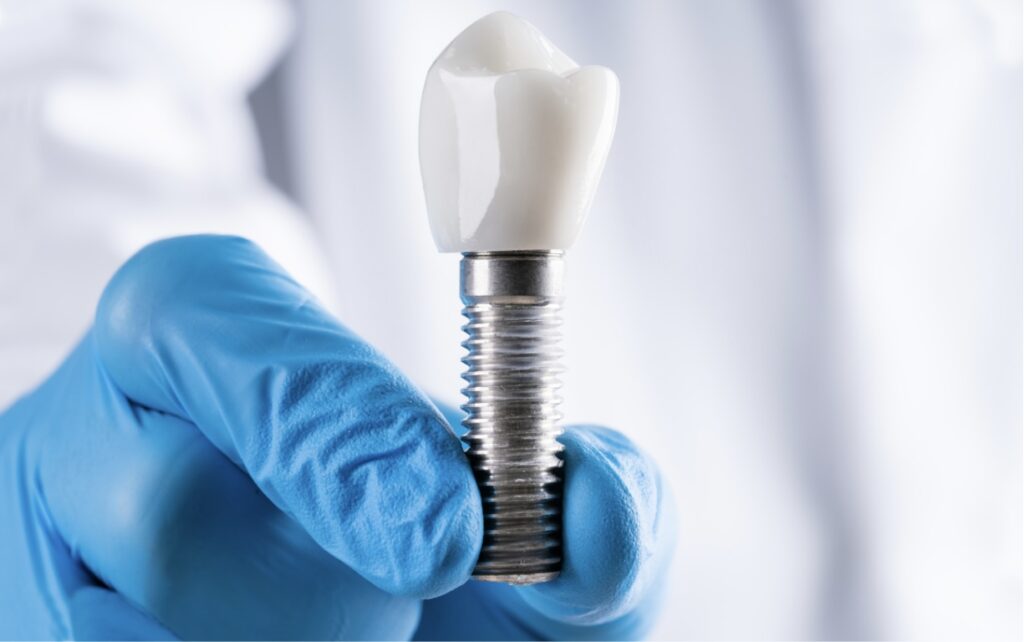 rechazo-implante-dental